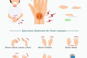 Solución: Dolor de muñeca por usar el mouse (Túnel carpiano) 5 Solución: Dolor de muñeca por usar el mouse (Túnel carpiano)